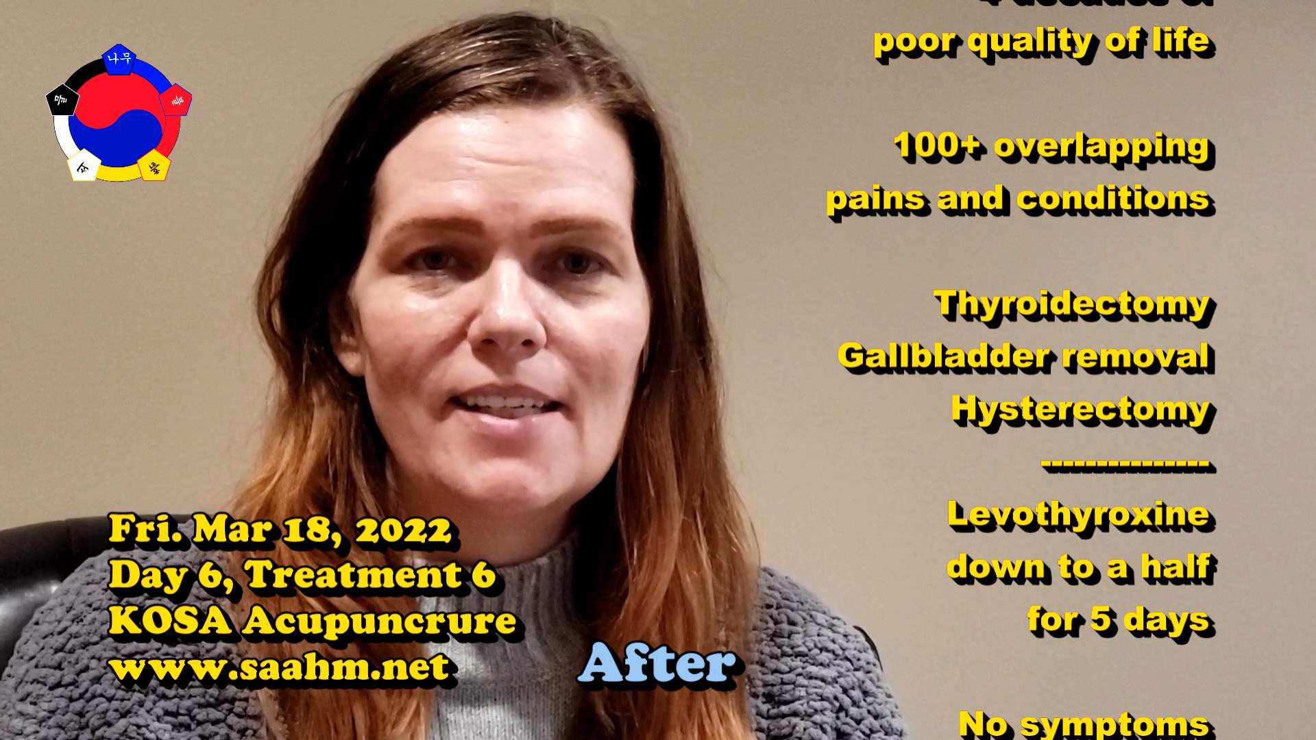 KOSA Acupuncture For A Better Quality Of Life #06 - Day 6, Tx 6 - Video Testimonial