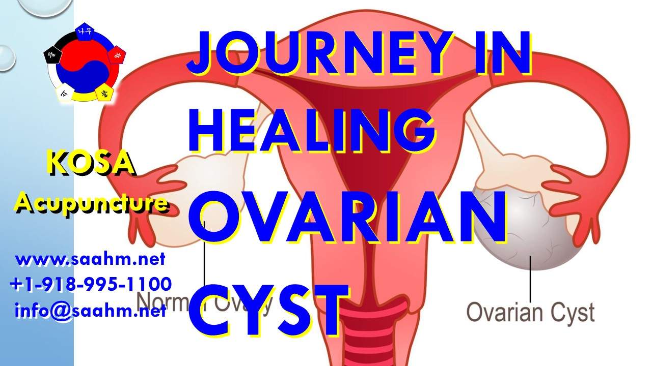 Ovarian Cyst Healing Journey with KOSA Acupuncture