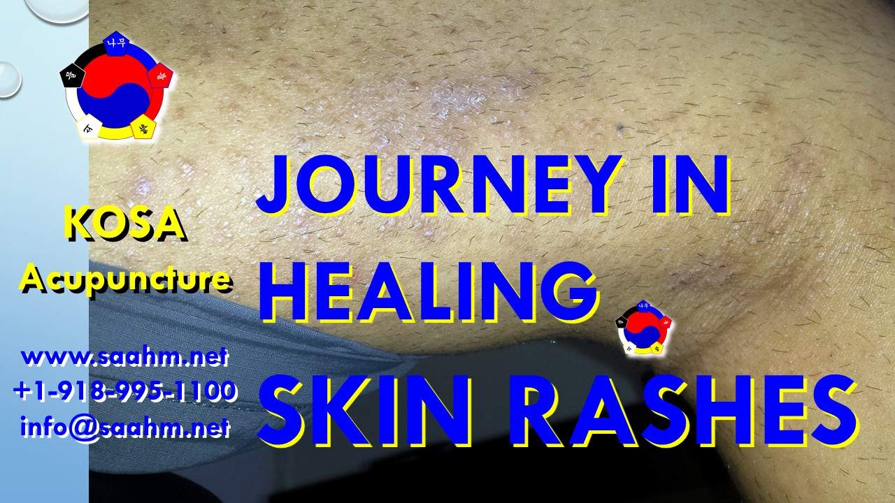 Skin Rahes