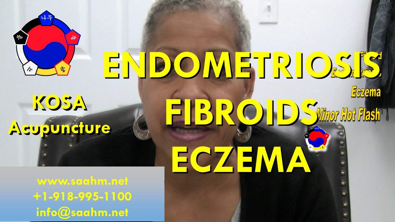Endometriosis, Fibroids, and Eczema Treatment By KOSA Acupuncture