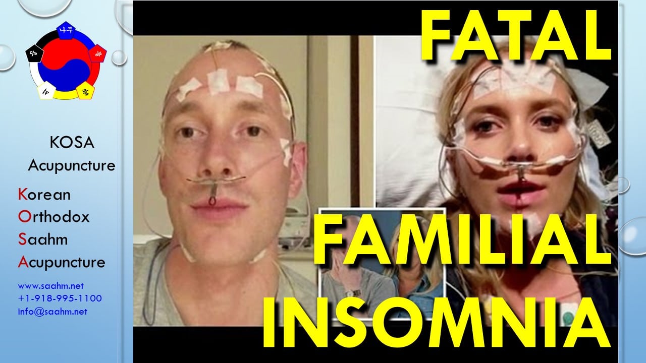 Insomnia, Sleep & Liver | KOSA Acupuncture